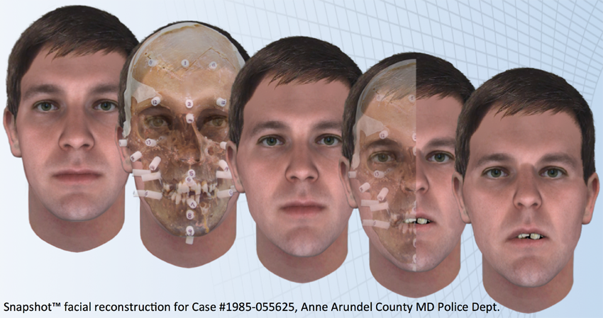 Snapshot™ Facial Reconstruction for Case #1985-055625, Anne Arundel County MD Police Dept.